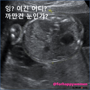슬라이드3.GIF