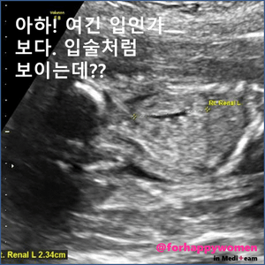슬라이드6.GIF