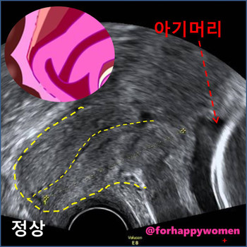 슬라이드5.JPG