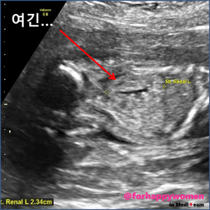슬라이드7.GIF