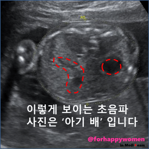 슬라이드4.GIF