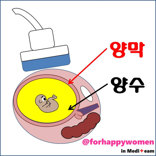양막.jpg