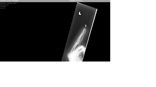 finger 3.jpg