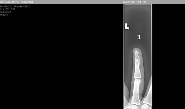 finger 2.jpg