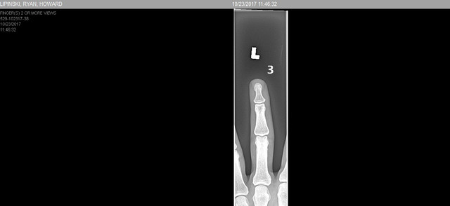 finger 1.jpg