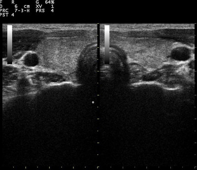 ultrasound.jpg