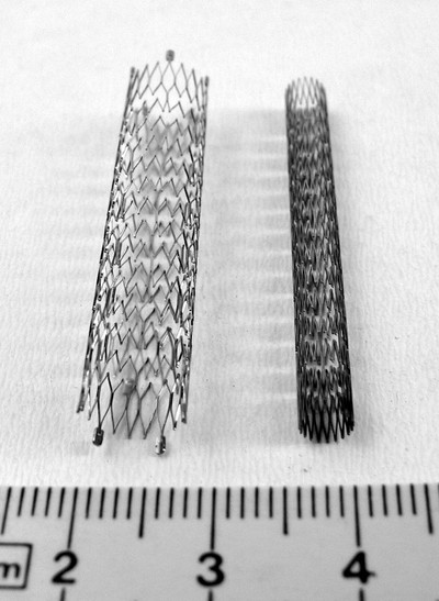 Stent4_fcm.jpg