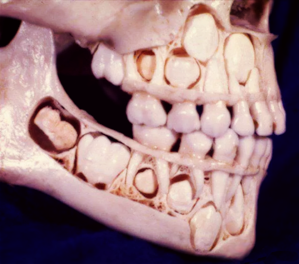 asi-se-ven-los-dientes-antes-de1.png