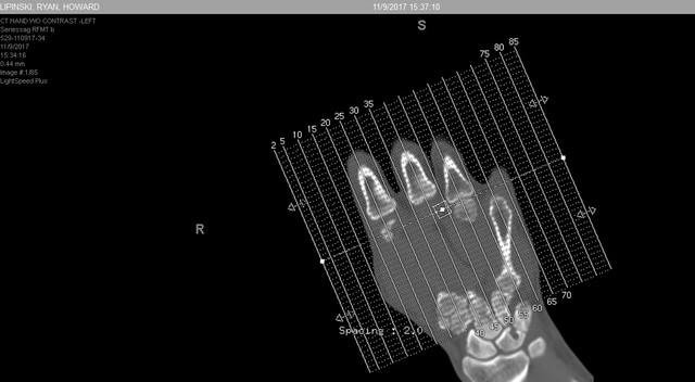 hand ct 2.jpg
