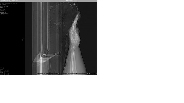 hand ct 4.jpg