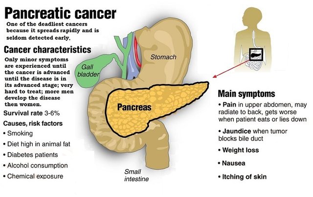 Menús para cáncer páncreas