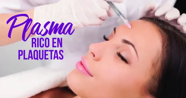 plasma-plaquetaslilian-768x403.jpg.webp