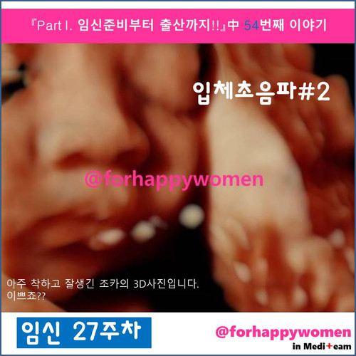 입체초음파2.jpg