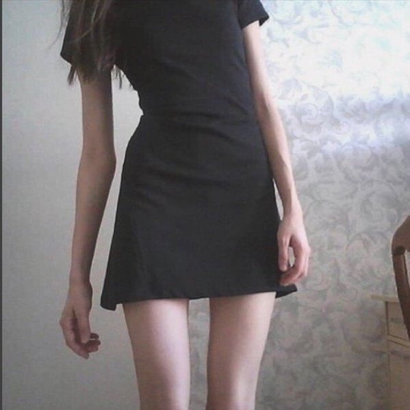 Худые руки ноги. Худые ноги у девушки. Красивая фигура анорексички. Худые руки ноги. Худые ноги.