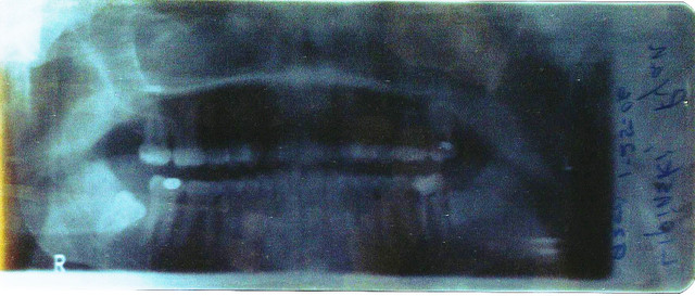 teeth xray 2.jpg