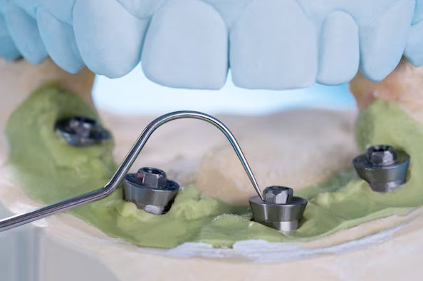 Dental Implants little rock ar.png