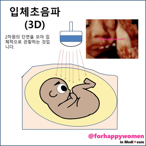 입체초음파(3D).jpg