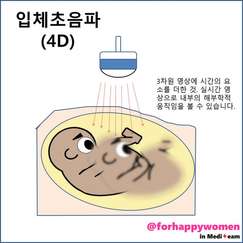 입체초음파(4D).jpg
