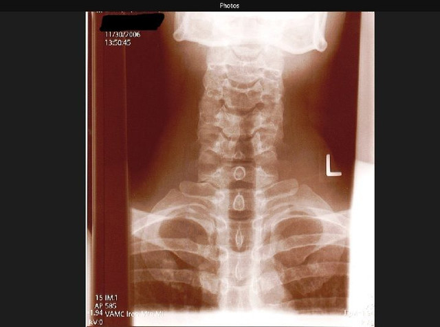 neck 5.jpg