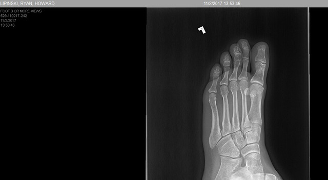 foot 2.jpg