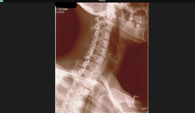 neck 3.jpg