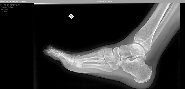 foot 6.jpg
