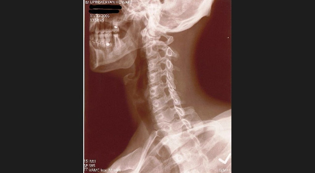 neck 2.jpg