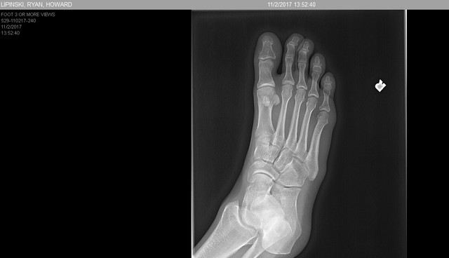 foot 5.jpg