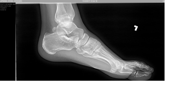 foot 3.jpg