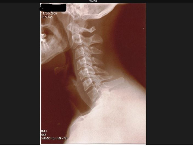 neck 4.jpg