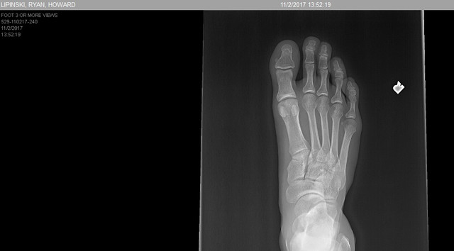 foot 4.jpg