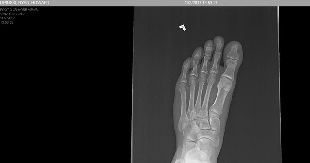 foot 1.jpg