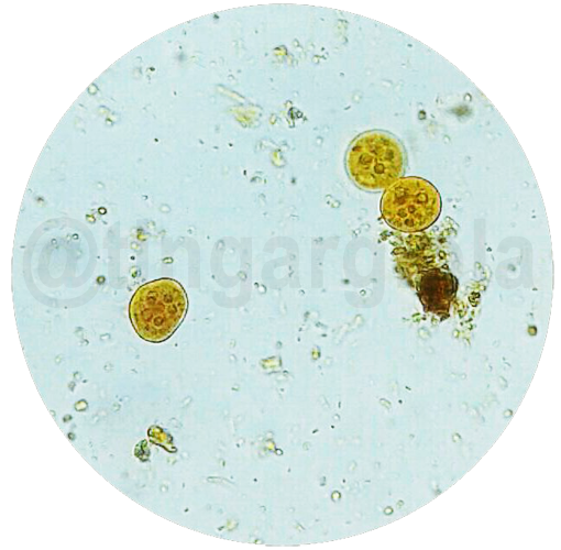 Entamoeba coli в кале. Цисты Entamoeba. Entamoeba histolytica в Кале. Entamoeba histolytica циста в Кале. Entamoeba coli циста.