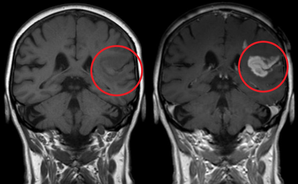 contrastmri.jpg