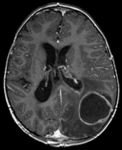 mri.jpg