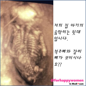 정밀초음파편4.jpg