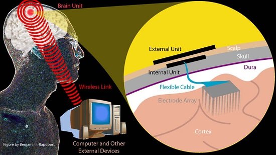 Neuralink brain interface