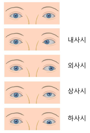 사시종류.jpg