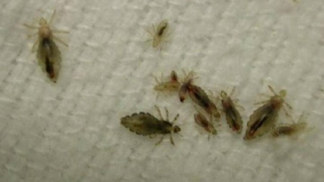 вши вылупляющиеся из гнид