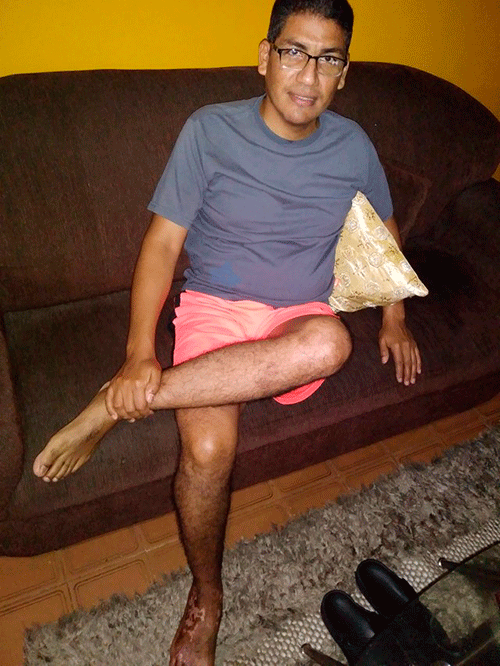 rodilla-izquierda.png
